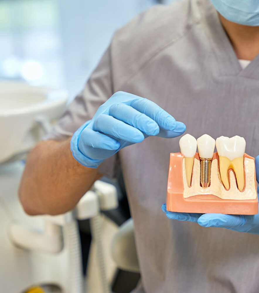 implante dental unitario