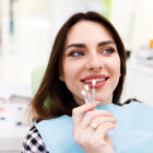 Carillas dentales: define una nueva sonrisa
