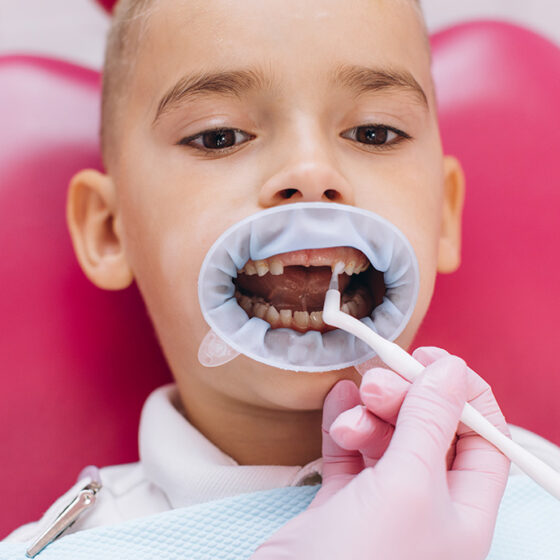 ortodoncia infantil interceptiva