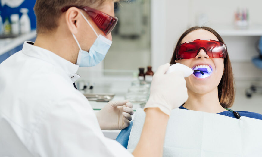 todo lo que debes saber sobre el blanqueamiento dental